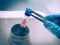 Cryogenics liquid nitrogen3