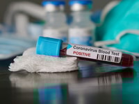 Positive blood test result for the new rapidly spreading Coronavirus, originating in Wuhan, China