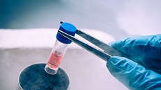 Cryogenic liquid nitrogen in laboratory