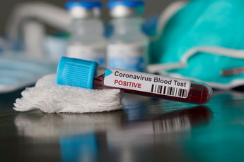 Coronavirus: An update from nexAir