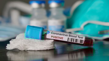 Positive blood test result for the new rapidly spreading Coronavirus, originating in Wuhan, China