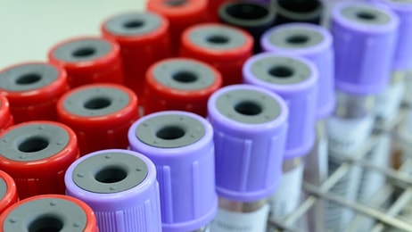 Laboratory medical