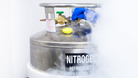 liquid nitrogen dewar medical