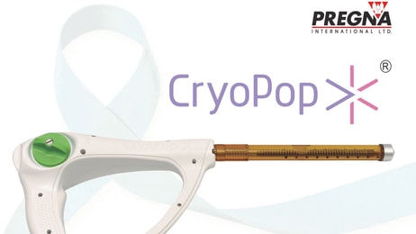 cryopop