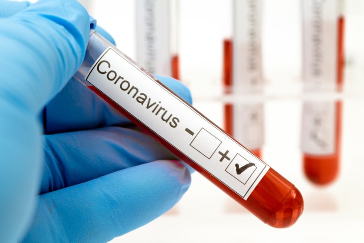 Coronavirus: An update from GE CEO